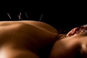 20% Off 1st Treatment Acupuncture